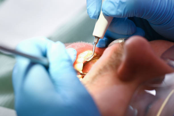 Best Emergency Pediatric Dental Care in Canton, IL